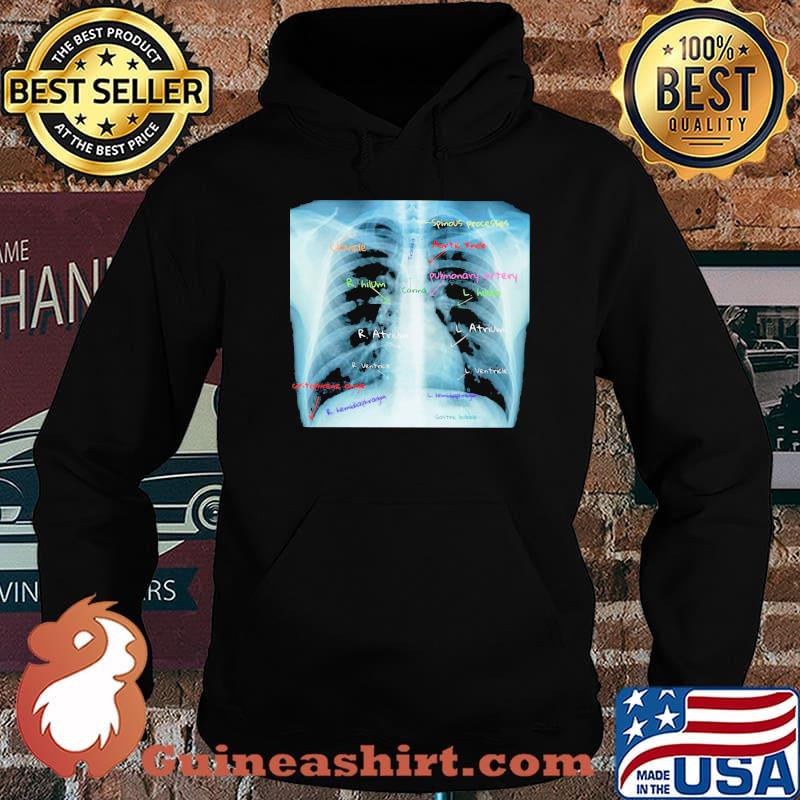 Chest X Ray With Labels Shirt Hoodie