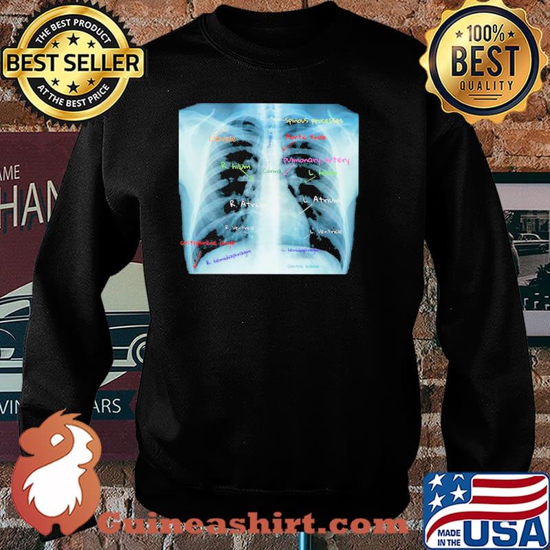 Chest X Ray With Labels Shirt Sweater