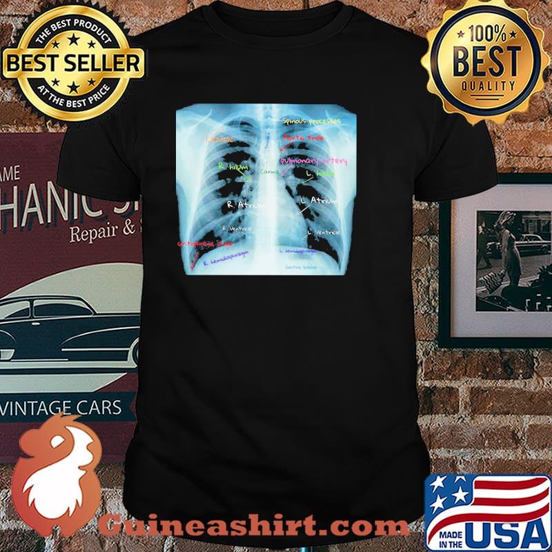Chest X Ray With Labels Shirt